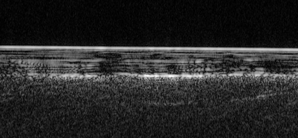 Radar image of ice-dust layers in south pole