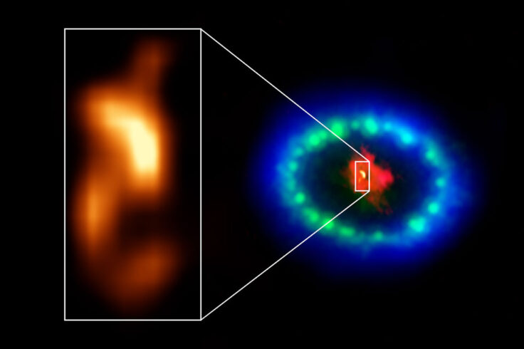 Dust-enshrouded neutron star in Supernova 1987A