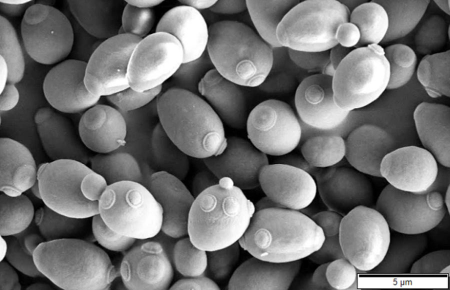 Yeast (Saccharomyces cerevisiae)